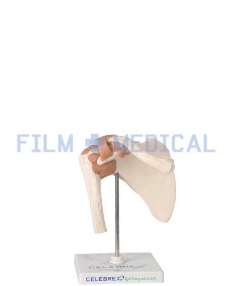 Anatomical Shoulder Model on White Base